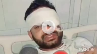 शाहजहांपुर: हिस्ट्रीशीटर पर जानलेवा हमला, आंख में पिस्टल की बट मारने का आरोप: पीड़ित ने दी हमले की जानकारी