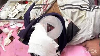 पुष्पराजगढ़: अमरकंटक में सड़क दुर्घटना, एक की मौत, दूसरा गंभीर रूप से घायल