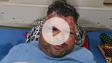 लाडपुरा: कैथून थाना क्षेत्र में 8 लाइन रोड पर मोटरसाइकिल फिसलने से एक युवक की मौत, एक घायल एमबीएस में भर्ती