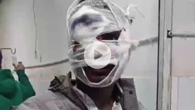 डंडा: नीलगाय को बचाने की कोशिश में बाइक सवार गंभीर रूप से घायल, मेदिनीनगर में इलाज जारी