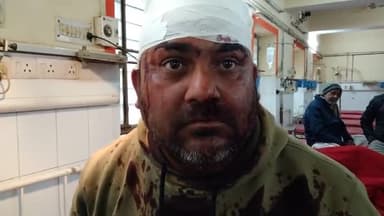 धौलपुर: मित्तल कॉलोनी के गेट के पास पशुओं की दवा लेने आ रहे पिता-पुत्र के साथ लोगों ने की मारपीट, पीड़ित ने दी जानकारी