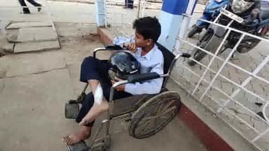 गोपालगंज: थावे रोड में बाइक के धक्के से छात्र हुआ घायल, इलाज के लिए सदर अस्पताल में भर्ती