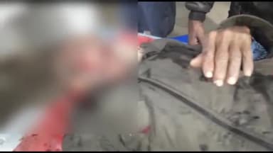 अररिया: बेलवा पुल के पास बाइक की टक्कर से एक व्यक्ति हुआ घायल, सदर अस्पताल में भर्ती