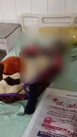 बहराइच: लौकना में बाइक की टक्कर से एक बच्ची हुई घायल, अस्पताल में इलाज जारी