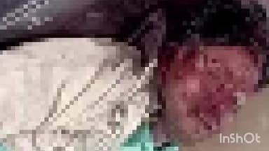 सिंगरौली: नवानगर थाना क्षेत्र में मिट्टी परिवहन करते समय ट्रैक्टर ट्रॉली पलटी, चालक की हुई दर्दनाक मौत