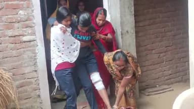 डुमरांव: पागल लंगूर ने बड़का ढकाइच में 15 से 20 लोगों को काटा, जख्मी लोग चलने फिरने में हैं असमर्थ