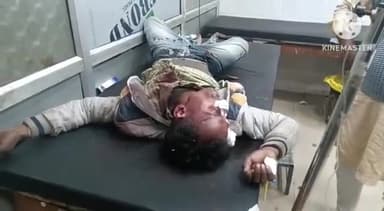 सुल्तानपुर: अमहट चौराहे के पास बाइक सवार को अज्ञात वाहन ने मारी टक्कर, घायल बाइक सवार को जिला अस्पताल से लखनऊ किया गया रेफर