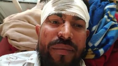 धौलपुर: बाल गोविंद के पुरा गांव मे लड़के के परिवार जनों ने लड़की के परिवार जनों के साथ की मारपीट 6 से अधिक लोग हुए घायल