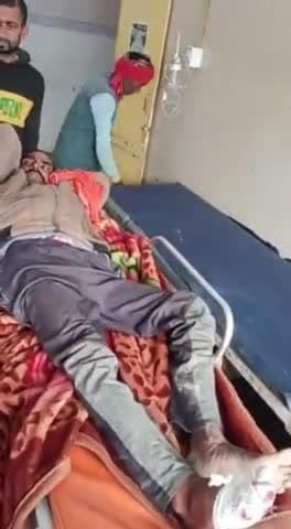 बहराइच: उदवापुर इलाके में इंजन की चपेट में आने से मजदूर हुआ घायल, अस्पताल में इलाज जारी