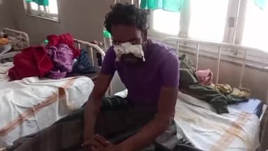 कटनी नगर: बरगवां के पास पैदल जा रहे युवक को एक युवक ने पत्थर से मारकर किया घायल, जिला अस्पताल में उपचार जारी