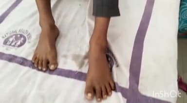 जहानाबाद: सुप्पी में फुटबॉल खेलने के दौरान एक किशोर हुआ घायल, लाया गया सदर अस्पताल