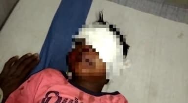 डलमऊ: पूरे कोईली के पुरवा गांव में घर के सामने खेल रही बच्ची को कुत्ते ने काटा, गंभीर हालत में जिला अस्पताल में भर्ती