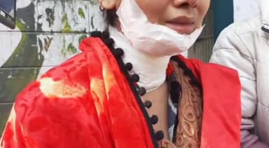 मेरठ: एसएसपी आफिस में युवती ने पुलिस पर हल्की धाराओं में केस दर्ज करने का लगाया आरोप, युवक ने धारदार हथियार से किया था हमला