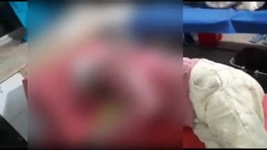 अररिया: बैरगाछी पेट्रोल पम्प के पास  ट्रक का टायर फट जाने से चालक हुआ घायल,सदर अस्पताल में ईलाज के बाद हायर सेंटर रेफर