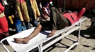 हाथरस: ग्राम कैमार के पास बाइक के सामने अचानक आवारा कुत्ता आ जाने के कारण बाइक हुई अनियंत्रित, एक व्यक्ति हुआ घायल