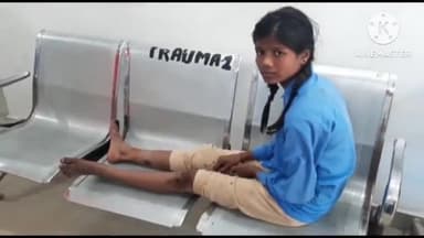 बिक्रमगंज: अनुमंडल के नटवार थाना क्षेत्र के मिल्की गांव में अनियंत्रित बाइक ने एक 12 वर्षीय लड़की में मारा टक्कर लड़की हुई घायल