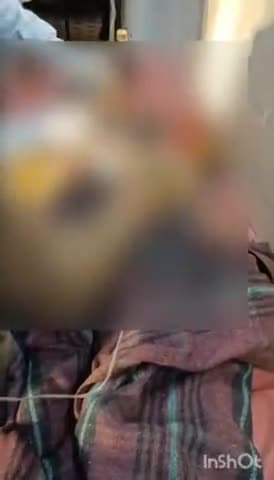 बहराइच: सुजौली में तेंदुए के हमले से 8 वर्षीय बच्ची गंभीर रूप से हुई घायल, पिता ने कड़ी मशक्कत कर तेंदुए से अपनी बेटी को छुड़ाया