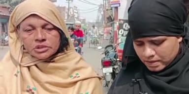 मेरठ: शाहजहां कॉलोनी की रहने वाली महिला के साथ ससुराल वालों ने की मारपीट कर से निकाला