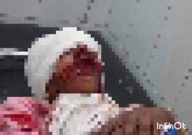 मवाना: दादुपुर गांव के शराब के ठेके के सामने सड़क दुर्घटना में एक महिला हुई घायल, चिकित्सकों ने उपचार के लिए किया मेरठ रेफर