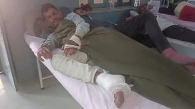 मथुरा: नए बस स्टैंड के समीप रेल लाइन पार करते वक्त मजदूर का पैर लाइन में फ़ंसने से टूटा, अस्पताल में घायल का इलाज जारी