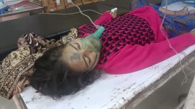 मथुरा: 22 वर्षीय युवती को आया हार्ड अटैक बेहोशी की हालत में उपचार हेतु अस्पताल में कराया भर्ती हालत गंभीर