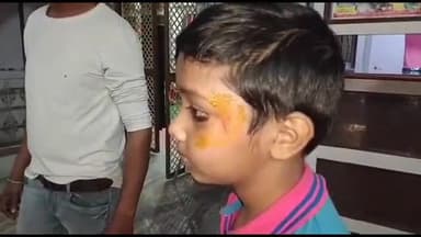 मथुरा: भरतपुर गेट बीके फादर स्कूल की टीचर ने होमवर्क न करने पर मासूम बच्चे को डंडे से पीटा