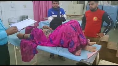 शिवपुरी नगर: खाना बनाते वक्त आग में झुलसी महिला, जिला अस्पताल में भर्ती, कोलारस थाना क्षेत्र के कुमरौआ गांव की घटना