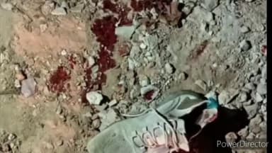 हुज़ूर: भोपाल के कोलार इलाके में पुरानी रंजिश को लेकर युवक पर कट्टे से फायर : पैर में लगी गोली