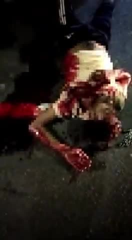 कन्नौज: बख्शीपुरवा गांव स्थित मल्लावा रोड पर अज्ञात वाहन ने बाइक में मारी टक्कर बाइक सवार दो लोग गंभीर रूप से घायल.