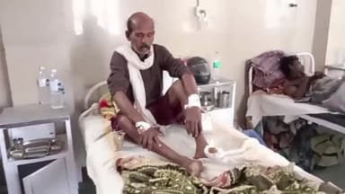 कटनी नगर: लकड़ी काटते समय एक व्यक्ति के पैर में लगी गैलेंडर मशीन पैर व हाथ पर आई गंभीर चोट जिला अस्पताल झिझरी के पास की घटना