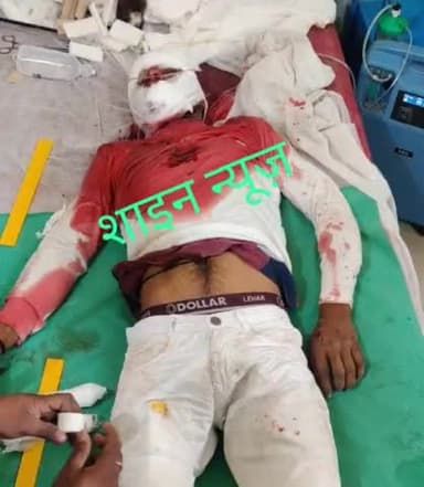 एटा-जसरतपुर थाना इलाके मे सड़क हादसे मे शिकार हुआ व्यक्ति,राजू पुत्र रामशरण यादव निवासी नगला नया PS जसरतपुर हुआ गंभीर घाय