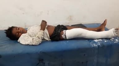 सासाराम: करसेरूआ गांव में छत पर से गिरकर घायल हुआ एक 7 वर्षीय लड़का, सदर अस्पताल में इलाज जारी