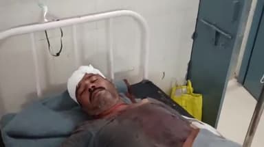 नरसिंहपुर: खुलरी ग्राम में दो पक्षों के बीच हुए जमीनी विवाद में 2 व्यक्तियों को आई गम्भीर चोट जिला अस्पताल में भर्ती