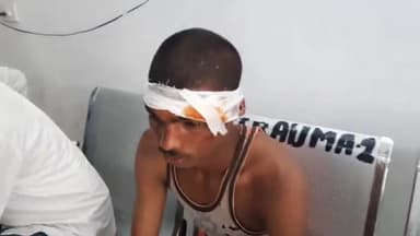 सासाराम: शिवसागर मोड़ पर अनियंत्रित कार ने एक युवक को मारी टक्कर, युवक हुआ घायल