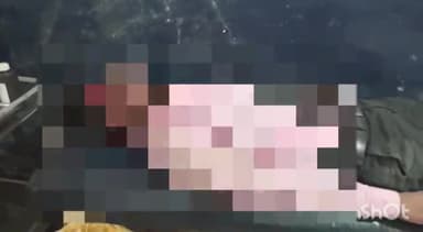 रायबरेली: पश्चिम गांव के पास विद्यालय जा रहे शिक्षक की स्कूटी अनियंत्रित होने से हुआ गंभीर घायल