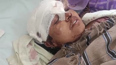 मथुरा: ग्राम गोकुल में जमीन को लेकर परिजनों ने महिला के साथ की मारपीट, पीड़ित ने पुलिस पर कार्रवाई नहीं करने का लगाया आरोप