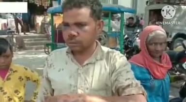 फरीदपुर: फरीदपुर तहसील क्षेत्र के गांव कुरमुरी में दबंग ने युवक को जलती हुई आग में दिया धक्का युवक झुलसा