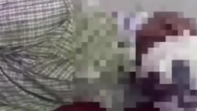 आलापुर: केदार नगर के समीप अनियंत्रित बाइक की चपेट में आने से युवक गंभीर रूप से हुआ घायल, लोगों ने अस्पताल में कराया भर्ती