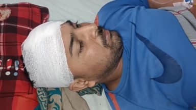 मथुरा: सदर बाजार क्षेत्र में गाली-गलौच की पड़ोसी से मना करने पर पड़ोसी ने पड़ोसी के साथ की मारपीट दो सगे भाई झगड़े में हुए घायल