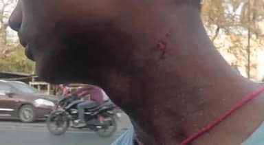 धनबाद/केंदुआडीह: सदर थाना क्षेत्र के पुलिस लाइन में स्थानीय युवकों ने मटन दुकान में किया मारपीट भीड़  के बाद युवक सभी  हुए फरार