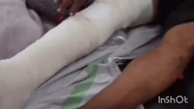 गुना नगर: जिले में जमीनी बटवारे को लेकर एक युवक पर हुआ जानलेवा हमला, जिला अस्पताल में उपचार जारी