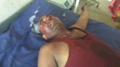 मुंगेर: नउवागढ़ी केशोपुर में छोटे भाई ने बड़े भाई व भाभी को मारपीट कर किया घायल, सदर अस्पताल में कराया गया भर्ती