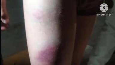 ललितपुर: चौबयाना निवासी दो मासूम छात्रों के साथ कोचिंग संचालक ने की मारपीट, वीडियो सोशल मीडिया पर वायरल