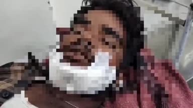 लटेरी: ग्राम पंचायत भगवन्तपुर के पास तेज़ रफ्तार मोटरसाइकिल गाय से टकराई, एक युवक हुआ घायल