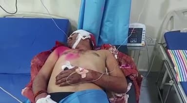 मऊ: पखईपुर गांव में पुरानी रंजिश को लेकर प्रधान पति पर हुआ जानलेवा हमला, परिजनों ने फायरिंग का भी लगाया आरोप