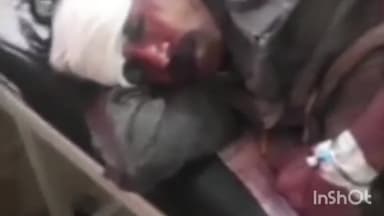 गुना नगर: म्याना क्षेत्र के हासलपुर ग्राम में दो भाइयों के साथ पुरानी रंजिश के चलते की गयी मारपीट, जिला अस्पताल में किया गया भर्ती