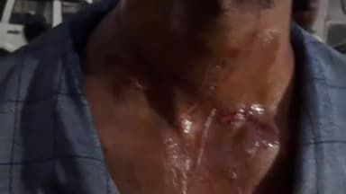 सिंगरौली: पोस्ट ऑफिस रोड निवासी पीड़ित व उसके परिवार वालों के साथ पैसे की लेनदेन के मामले में की गई मारपीट,कोतवाली में शिकायत दर्ज