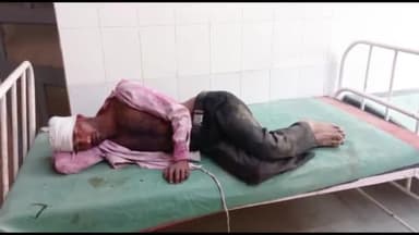 जलालाबाद: गांव कल्याणपुर में भाभी को रंग लगाने से मना करने पर दबंगों ने युवक को पटक कर किया घायल, थाने में दी तहरीर