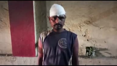 जलालाबाद: गांव कटकिया मोड़ पर बदमाशों ने घात लगाकर एक शख्स को पीटा, फटा सिर