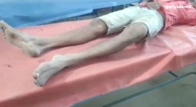 अररिया: अररिया आरएस स्थित वार्ड नंबर 2 में घरेलू विवाद में हुई मारपीट की घटना में एक व्यक्ति जख्मी, सदर अस्पताल में भर्ती